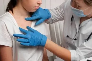 Recomiendan cuidados especiales a niños con dermatitis atópica