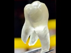 Dientes impresos en 3D, la solución a las caries