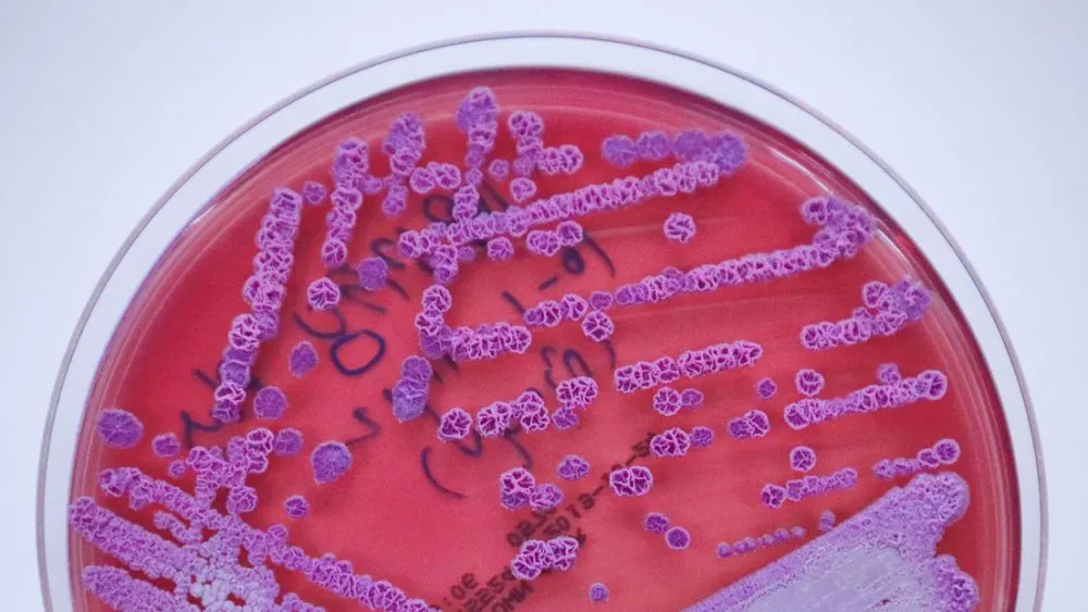 Encuentran bacteria que provoca rara enfermedad en EU