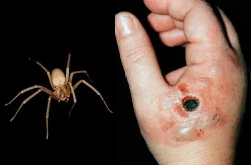 Video: ¡Cuidado! La araña violinista, el peligro que llega con las lluvias