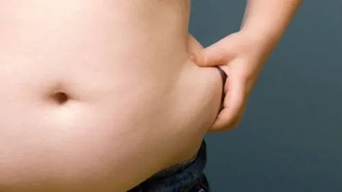 El 70% de los fallecimientos en México son consecuencia de la  obesidad