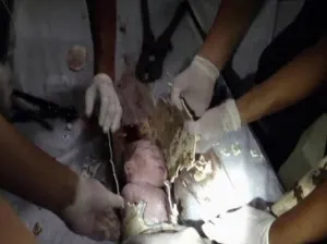 Recién nacido fue tirado por el retrete en China; lo rescatan vivo