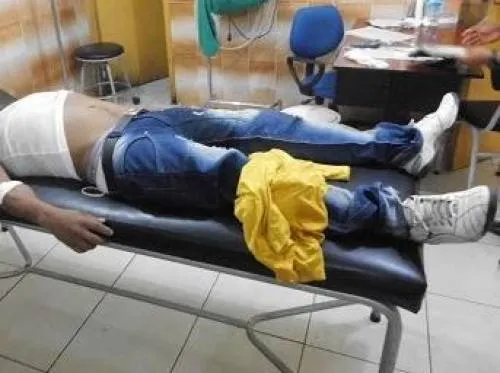 Un Joven se dispara en el rostro