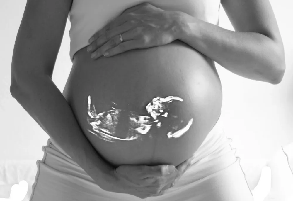 Aborto