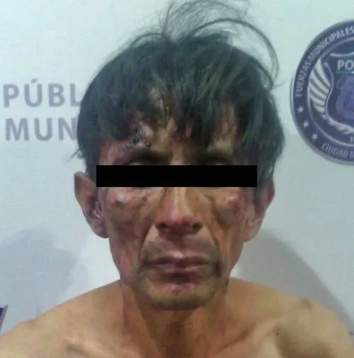Detiene SSPTM a probable multidelincuente; ya se encuentra en prisión