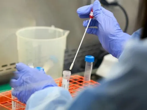 Estudios de hace décadas alertaron de una emergencia mundial por coronavirus