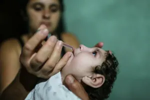 Confirmanl 1er caso de microcefalia asociado a virus Zika en México