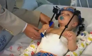 Doctores logran unir la cabeza de un niño decapitado en un accidente en Australia