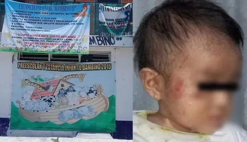 Niño golpea a bebé en guardería