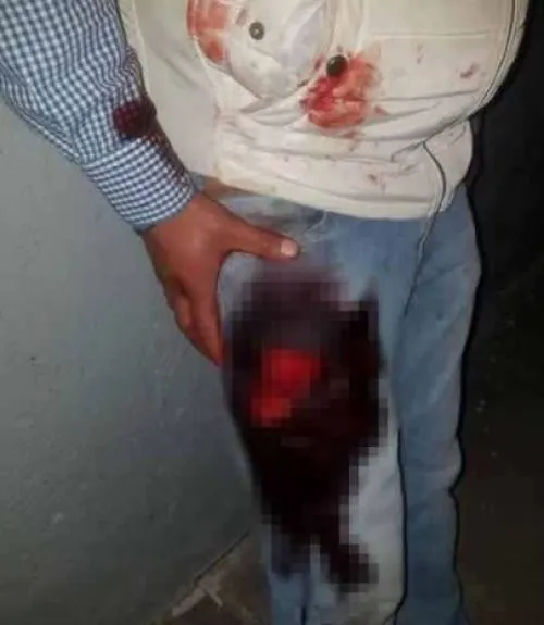 Enfrentamiento entre delincuentes deja tres personas heridas en La Esperanza