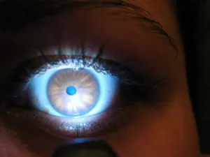 Cirujanos evitan ceguera implantando un gen en las células oculares
