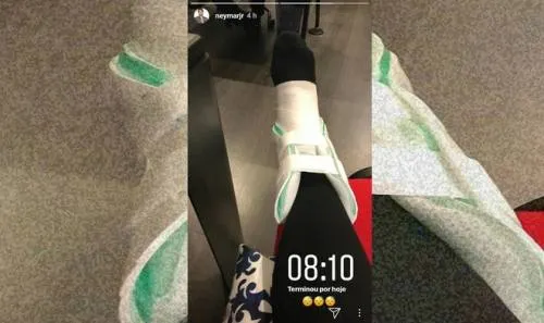 Así está el tobillo de Neymar…