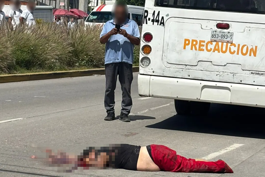 Mujer Atropellada Ruta 44 La Margarita