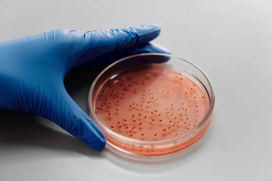 Brote de Salmonella afecta a 135 médicos del Hospital General de México