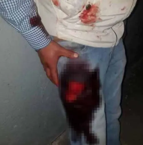 Enfrentamiento entre delincuentes deja tres personas heridas en La Esperanza