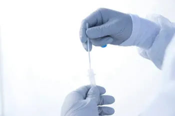 Atiende Salud a 17 personas hospitalizadas por COVID-19 en Puebla