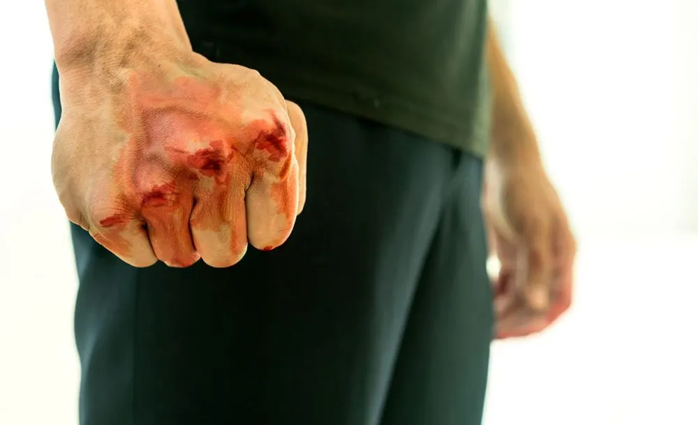 Golpes Violencia Puno