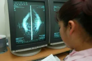 Cada año la cifra de casos de cáncer en el mundo aumentará en 22 millones: OMS