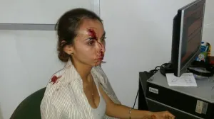 CIDH condena ataque a reportera de Guanajuato