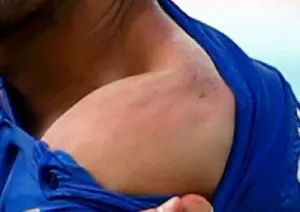 Luis Suárez repasa a italiano con senda mordida