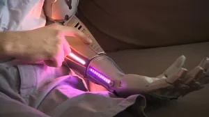 Perdió su brazo y ahora tiene uno biónico con láser, puerto USB y un dron